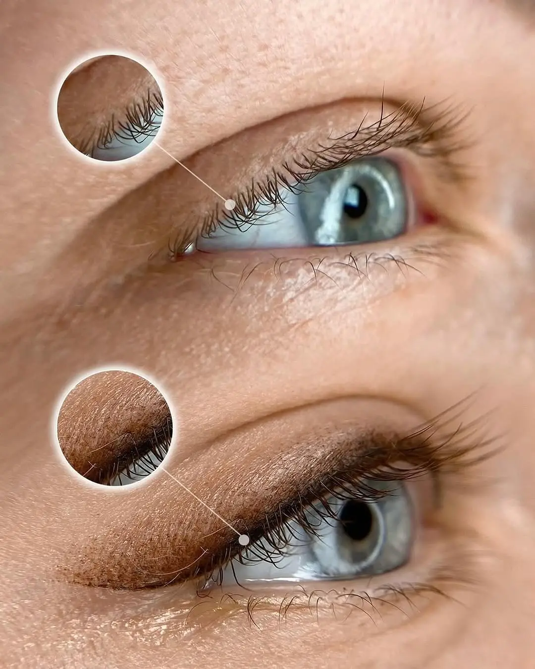 Lidstrich & Wimpernkranzverdichtung