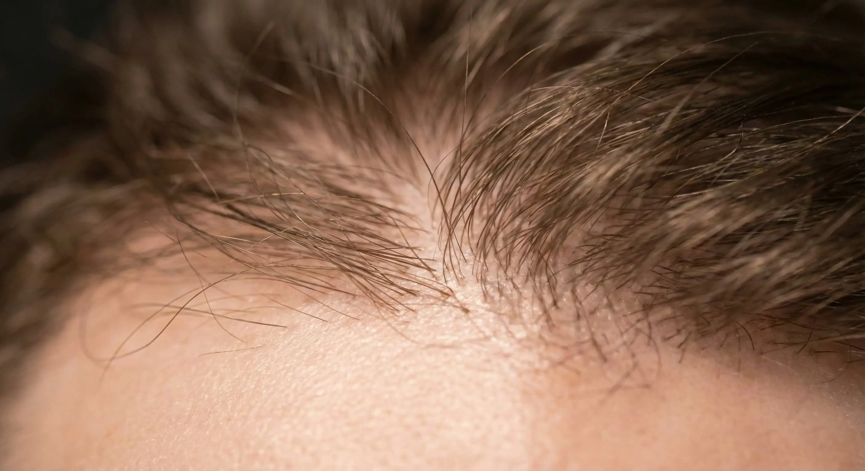 Ozontherapie für gesundes Haarwachstum